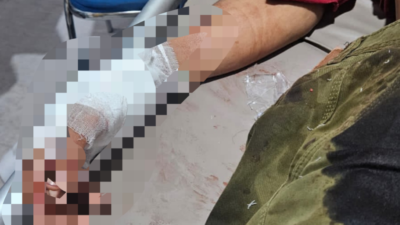 Aksi Curas Gunakan Senpi, Seorang Warga Cikalongkulon Terluka.