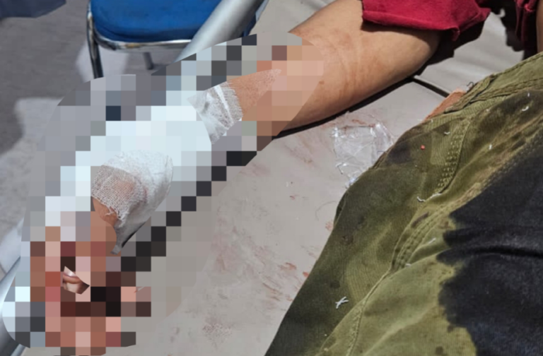 Aksi Curas Gunakan Senpi, Seorang Warga Cikalongkulon Terluka.